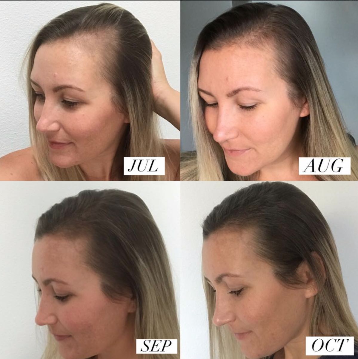 Viontea™ Scalp Massager